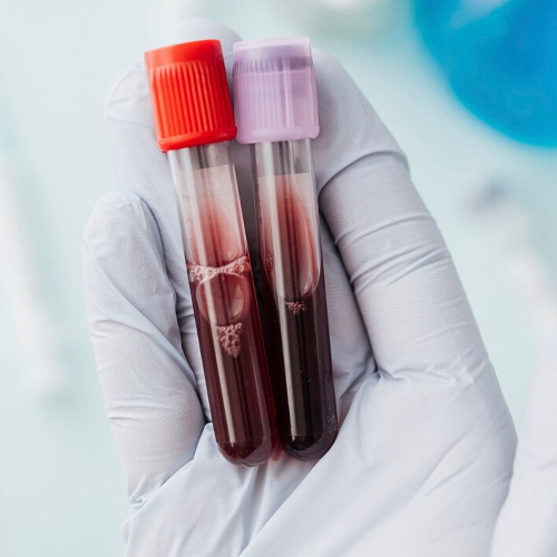 Blood Test at Home in Chennai